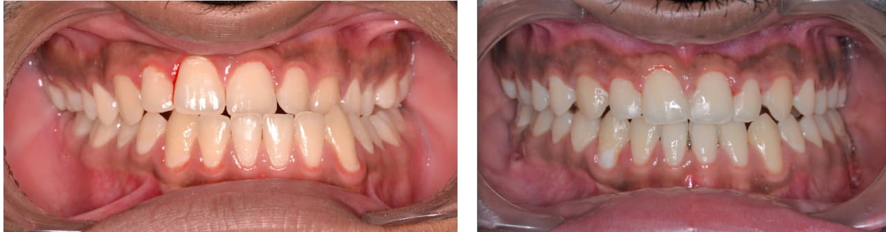 MV-Orthodontics