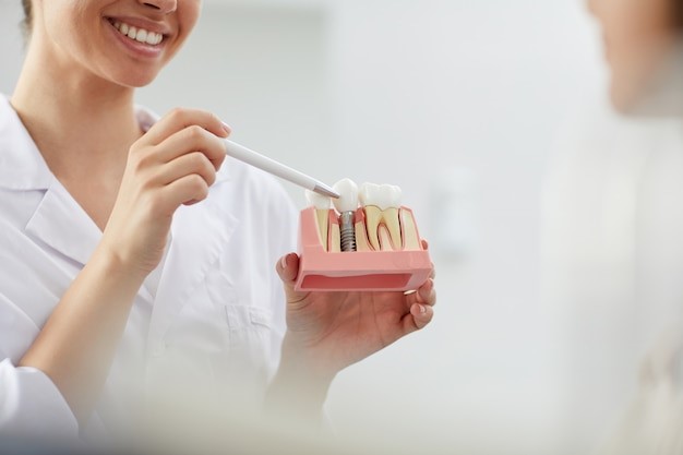 dental implants in Dubai