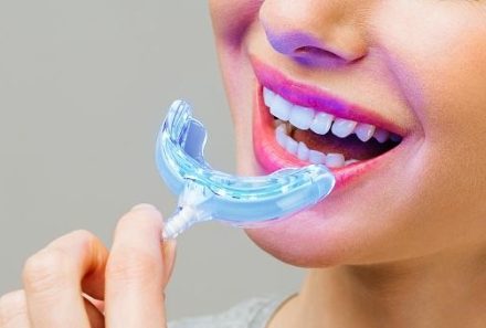 How to keep your smile healthy?