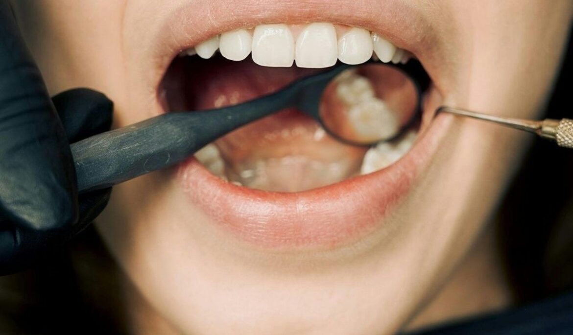 Best Zoom Teeth Whitening Clinic in Dubai: Your Complete 2025 Guide