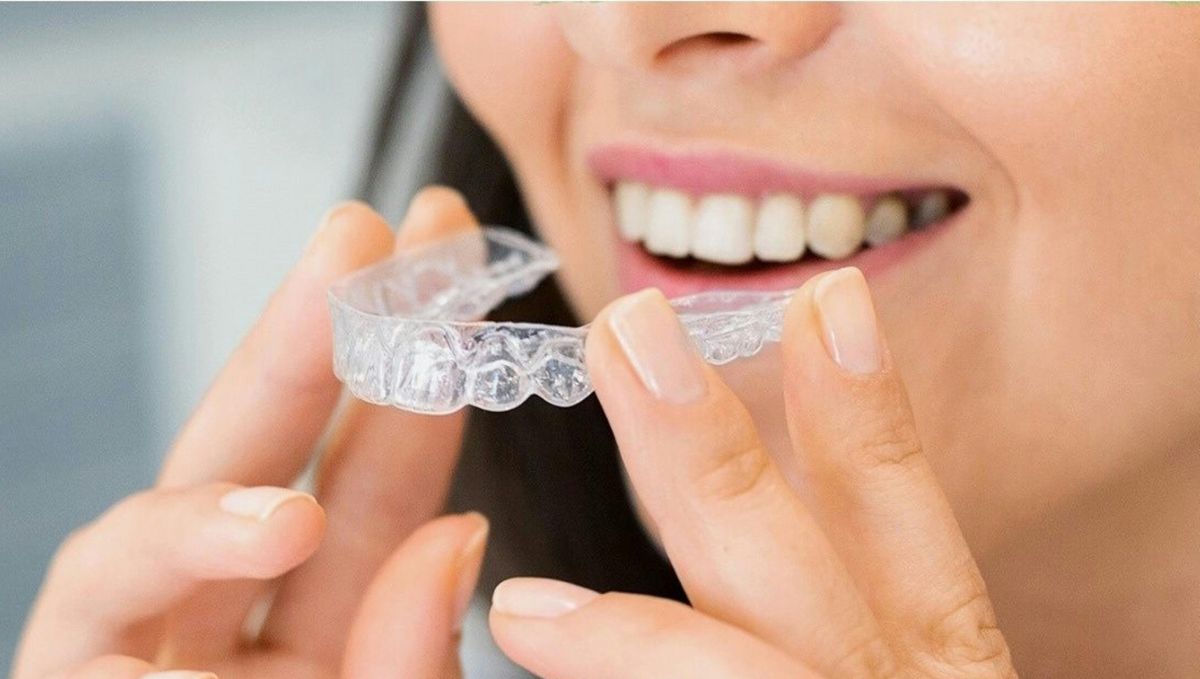 The Rise of Invisible Dental Braces in Dubai: How to Choose the Right Dental Treatment