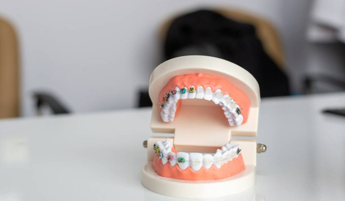 The Complete Guide to Finding the Best Orthodontist in Dubai: What Every Patient Should Know