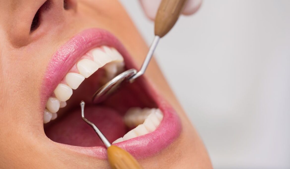 Teeth Whitening in Dubai: Everything You Need to Know For a Brighter Smile